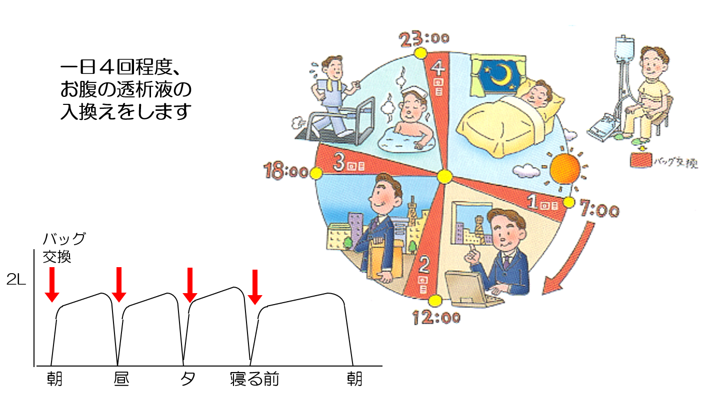 腹膜透析療法マニュアル | 細谷龍男, 横山啓太郎 |本 | 通販