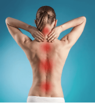 Photo du dos d'une femme qui tient sa nuque en douleur