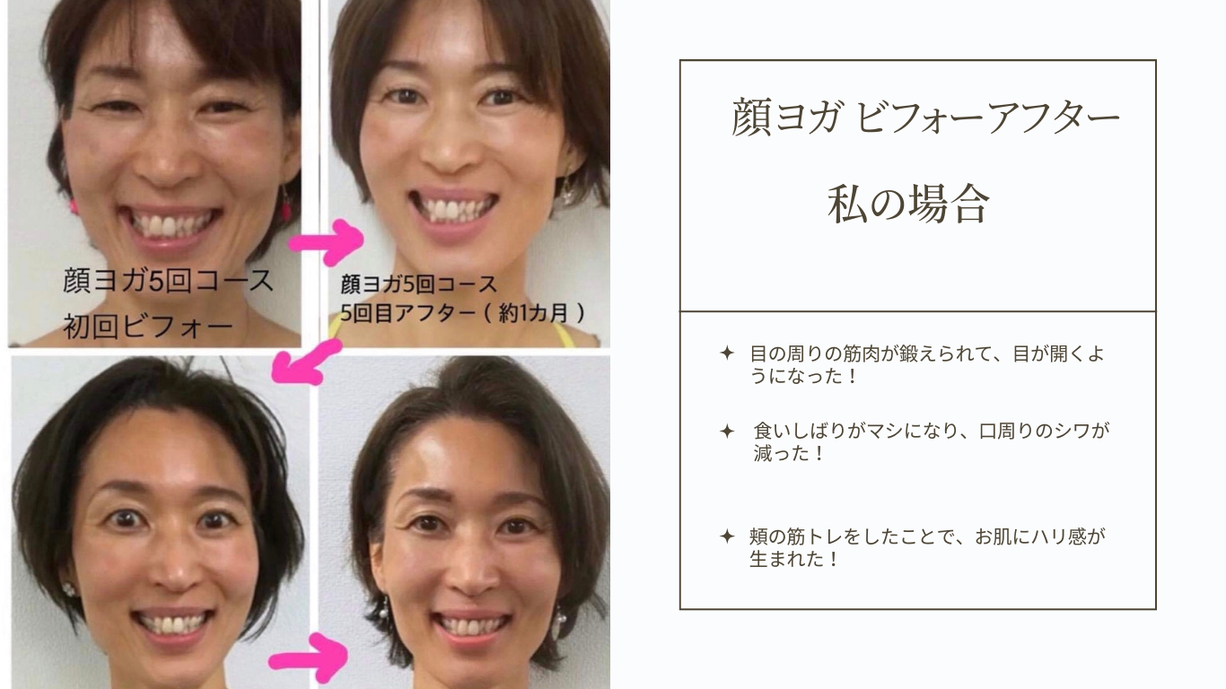 【顔ヨガ】顔ヨガとは？ ビフォーアフター ～私の場合～