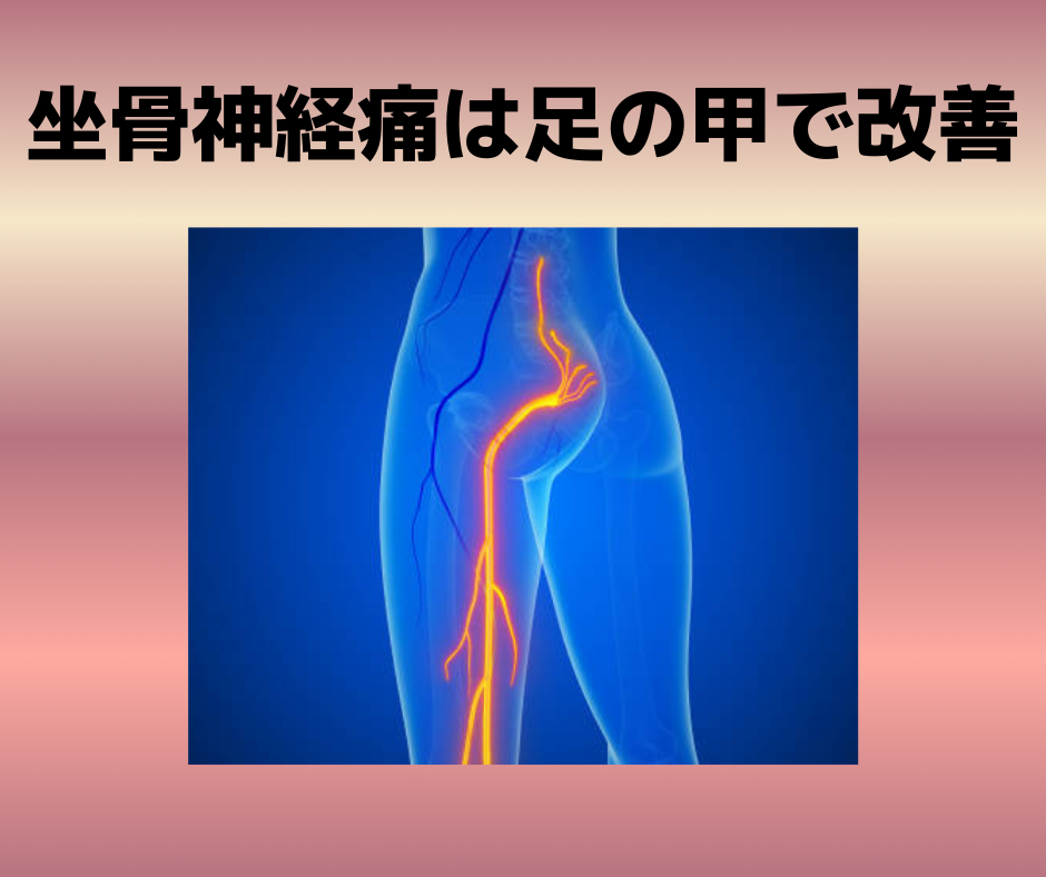 坐骨神経痛は足の甲で改善