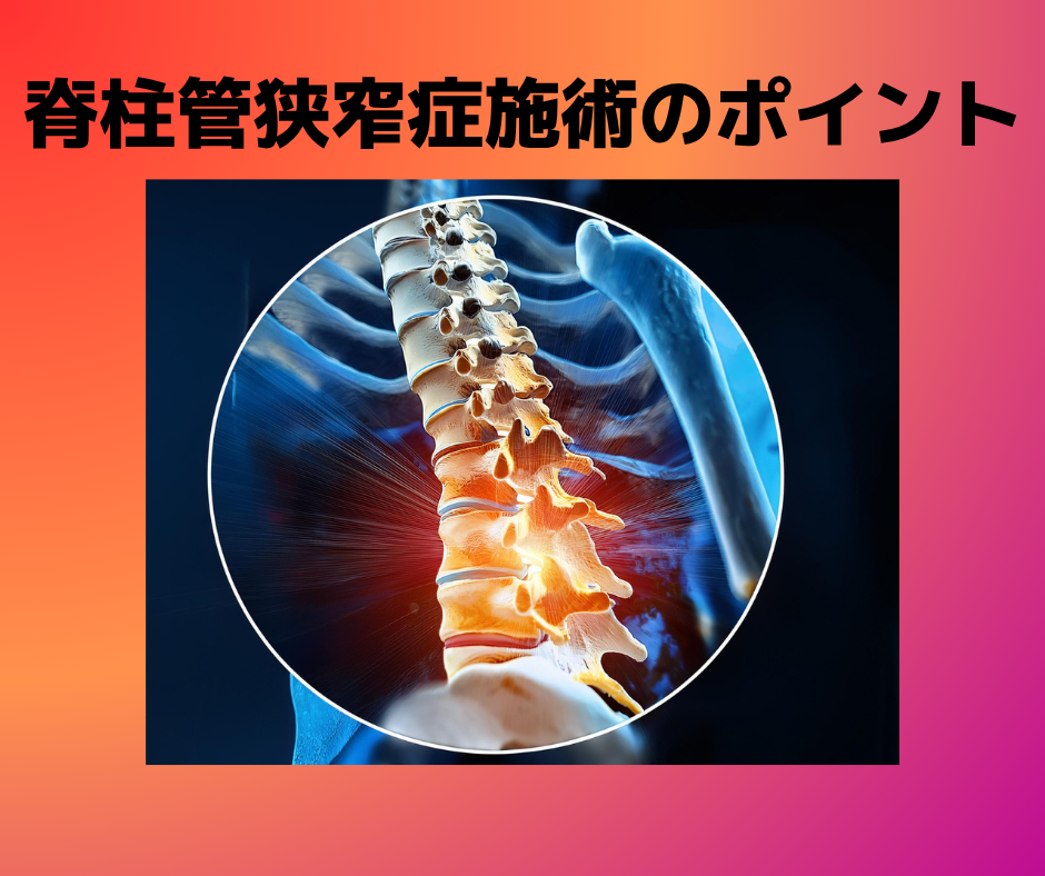 脊柱管狭窄症施術のポイント