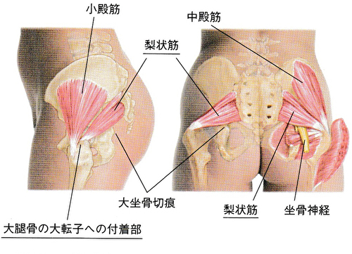 梨状筋の付着部