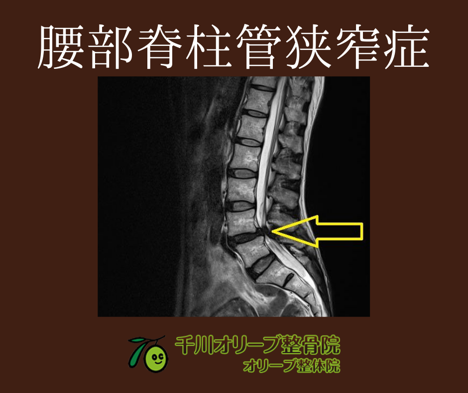 腰部脊柱管狭窄症の手術費用と入院日数