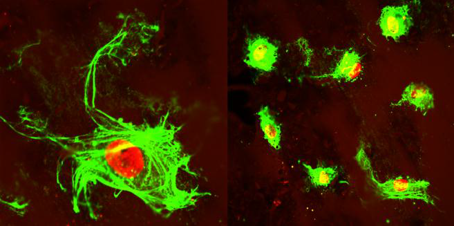 Confocal microscope image of human fetal lung fibroblast-like cells (MRC-5) grown on a poly(vinyl alcohol)/CNC (16 wt. %) substrate after 5 days of incubation.