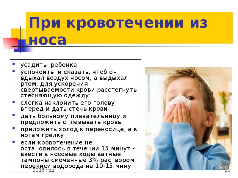 Носовые кровотечения у детей могут возникать. При носовом кровотечении у детей. При носовом кровотечении у ребенка его необходимо. Памятка при носовом кровотечении у детей. Диагноз при носовом кровотечении.