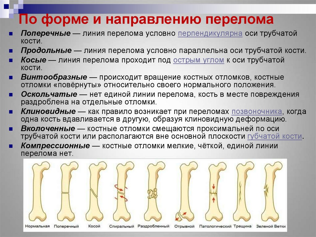 Образована тремя сросшимися костями. Переломы по форме и направлению. Переломы по форме и направлению перелома. Классификация переломов по направлению и форме.