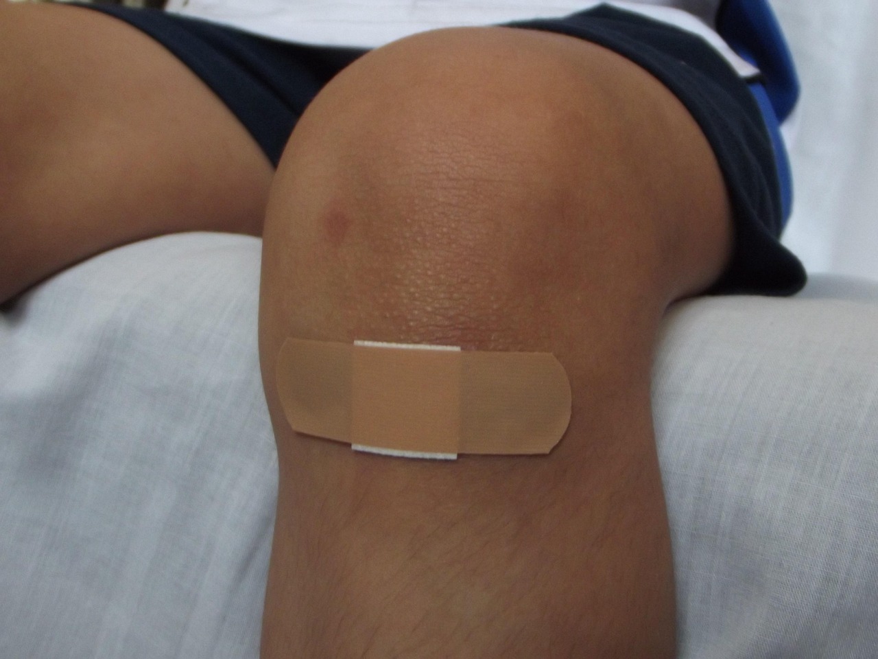 Frühe Wundheilungsphase/ early stage of wound healing