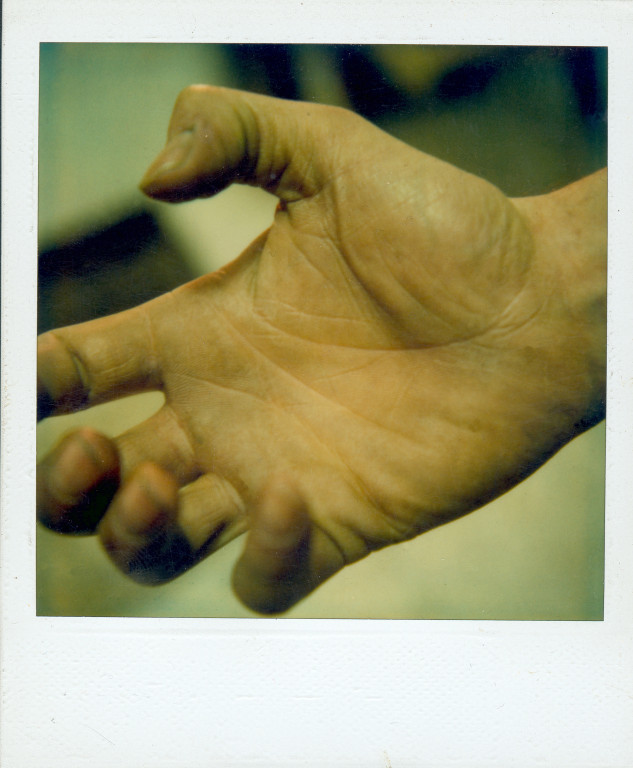 Meine Hand, ca.1982