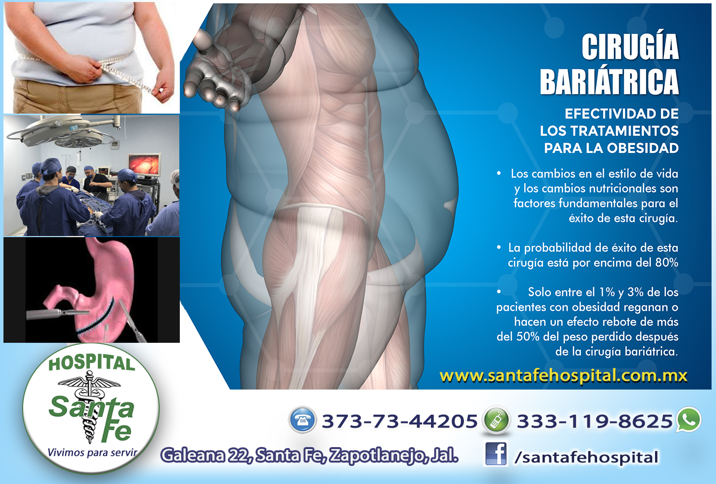 Cuanto Cuesta Una Operacion Bariatrica Cirugia Bariatrica - Hospital Santa Fe