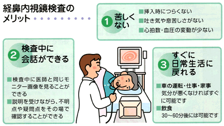 経鼻内視鏡 鼻からの胃カメラ 渡辺内科 名古屋
