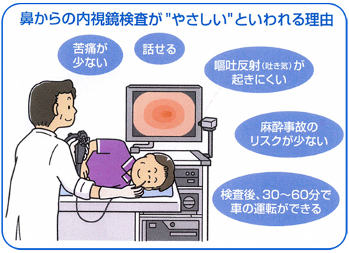 経鼻内視鏡 鼻からの胃カメラ 渡辺内科 名古屋