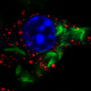 The image shows an infected cell with staining for Mycobacterium tuberculosis (green), the cell nucleus (blue) and a host protein involved in detection of intracellular pathogens (red). (Image Credit: Shivangi Rastogi)