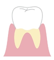 歯,黄ばみ,ホワイトニング,原因,対策
