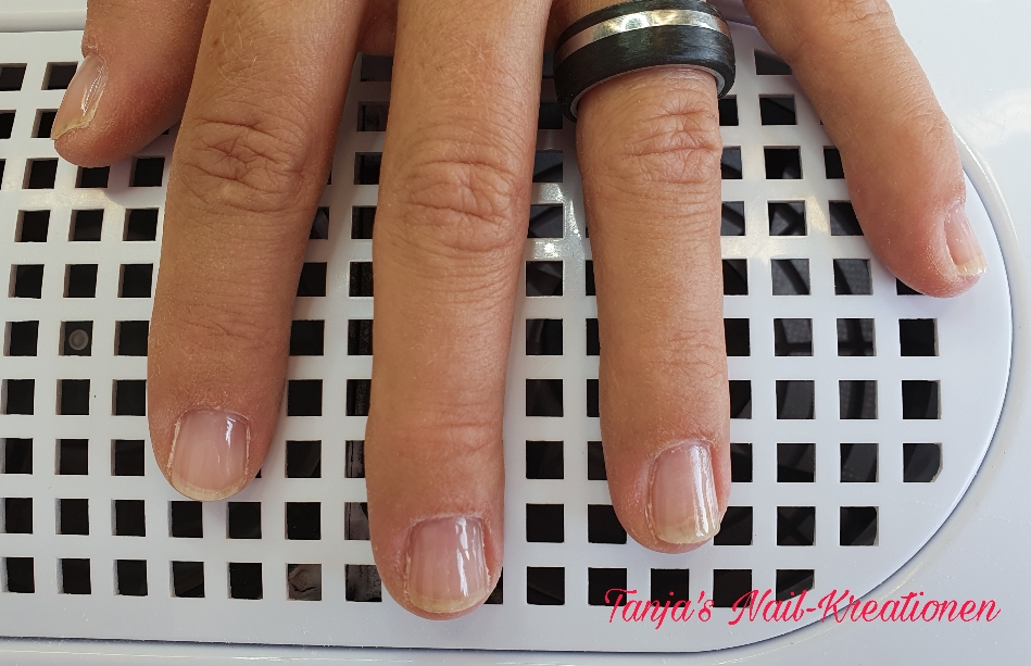 Shellac entfernt, nach Maniküre