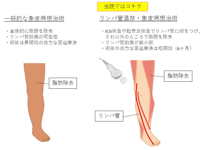 日帰りLVA手術　保存療法　三原誠　蜂窩織炎　手術　治療　名医　その10