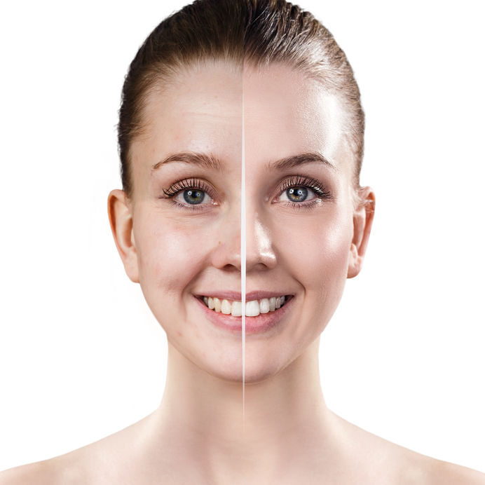 Skin Detox la pelle asfittica Salus House centro estetico e