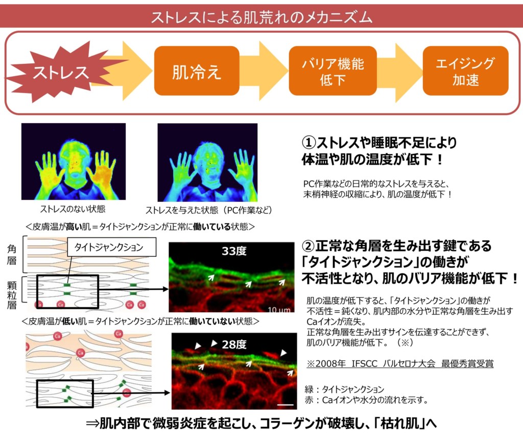 ストレスによる肌荒れのメカニズムが解明 - 天然ヒト型セラミド