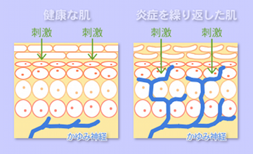 痒いを感じる神経