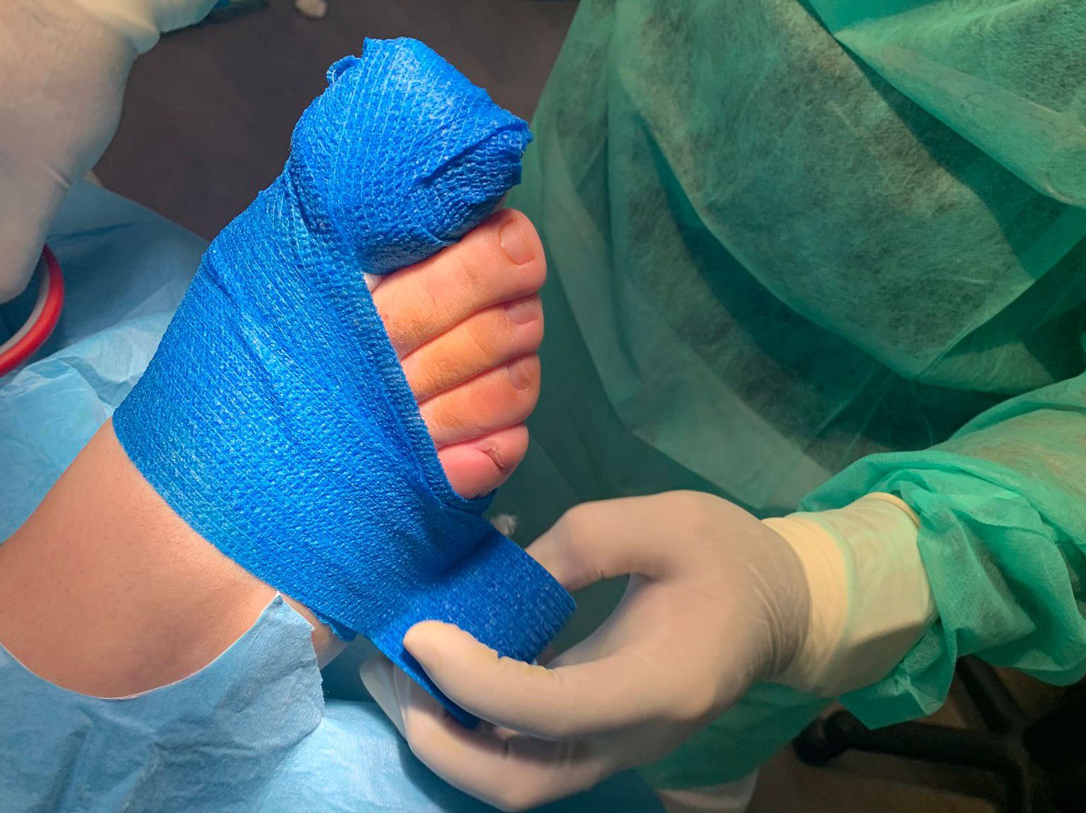 Cirugía ungueal en Lepe: tratamiento definitivo para uñas