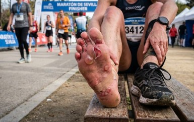 Ampollas en corredores en Lepe: cómo prevenirlas y tratarlas