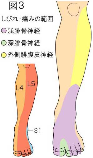痺れ 足 の 小指