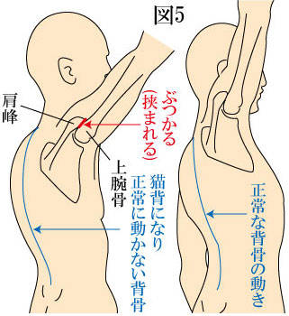 五十肩と背骨 骨盤 やまだカイロプラクティック 鍼灸院ホーム ページ