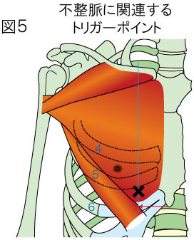 不整脈に関連するトリガーポイント