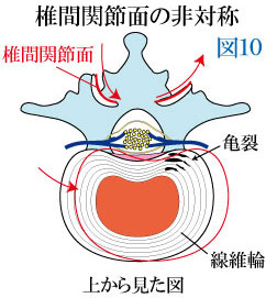 椎間関節の非対称