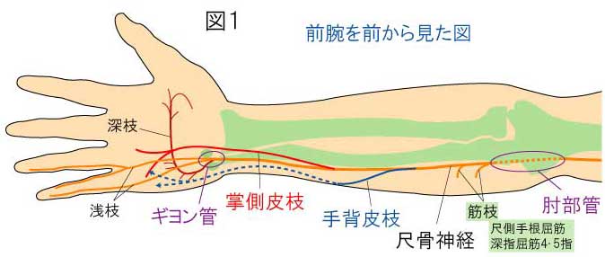 人気を誇る 肘部管症候群とギヨン管症候群 やまだカイロプラクティック - 医学一般
