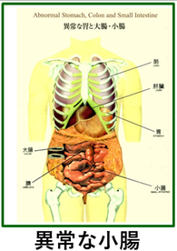 異常な小腸