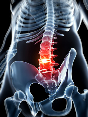 Back pain  from spine problem