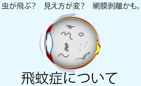 飛蚊症で困ってます！パートⅡ
