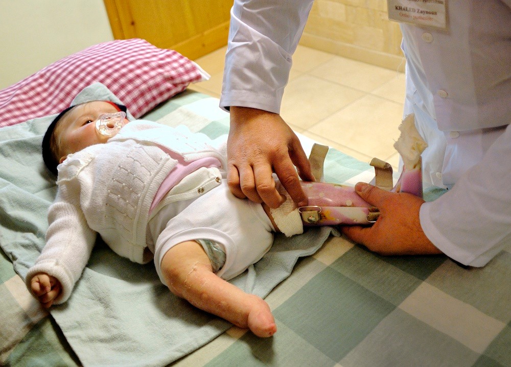 Experts in artificial limbs - Tdh Syria - Damascus - Syria © François Struzik - simply human 2011