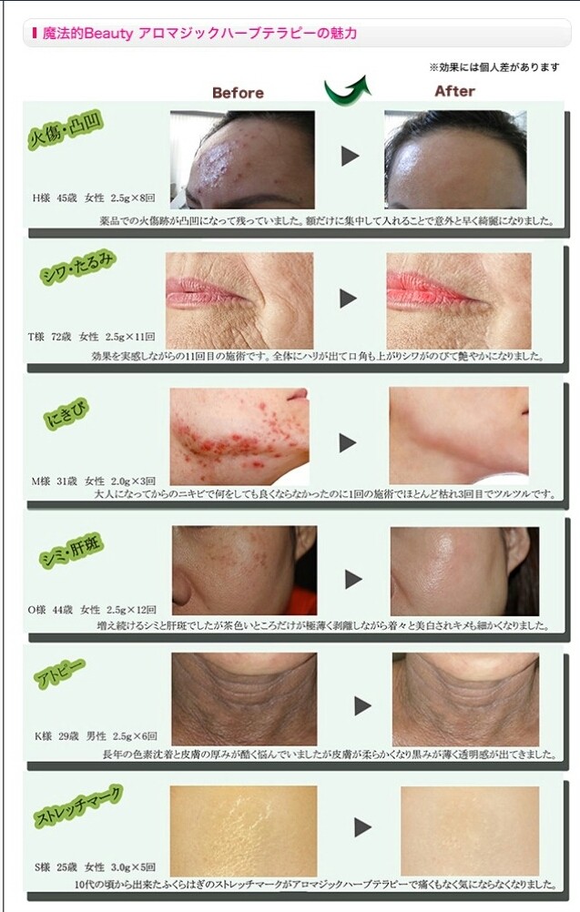 大人気 Aromagicハーブテラピー Lien リアン 大人気 Aromagicハーブテラピー Lien リアン