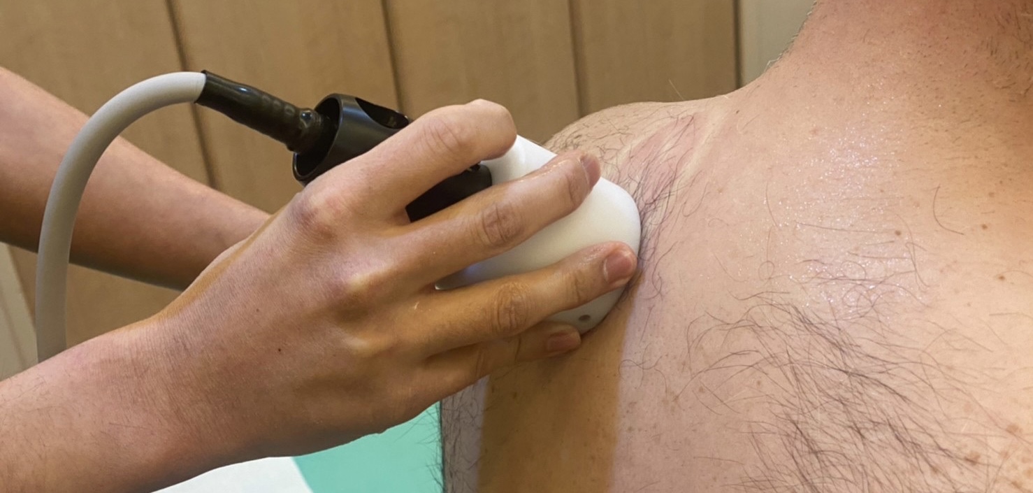 メディセルで行う筋膜リリースとは