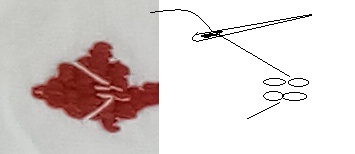 Prinzip fliegende Nadel