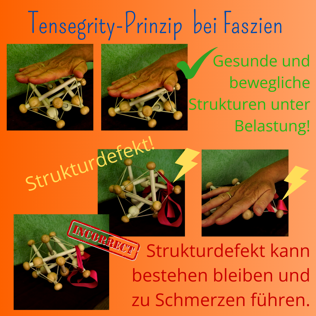 Was haben Rückenschmerzen mit Tensegrity zu tun?