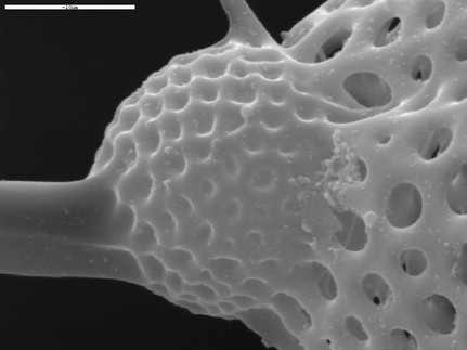 Rasterelektronenmikroskopie: Diatomeen (Bild: HS-Koblenz)