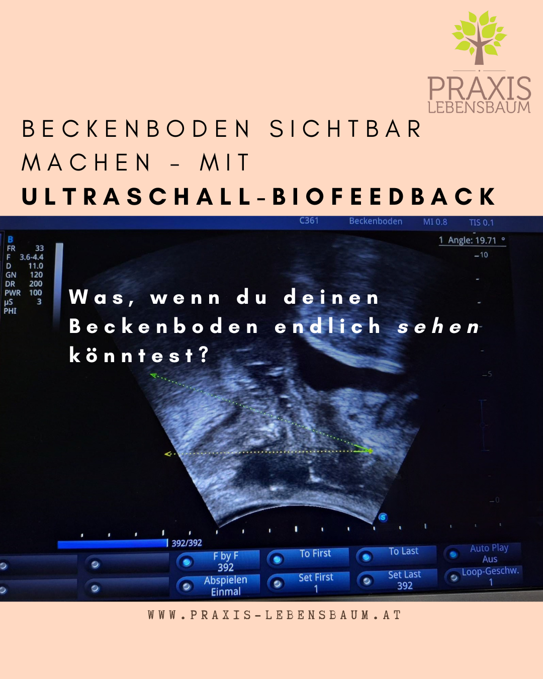 Ultraschall in der Physiotherapie bei gynäkologischen, proktologischen und urologischen Patientinnen