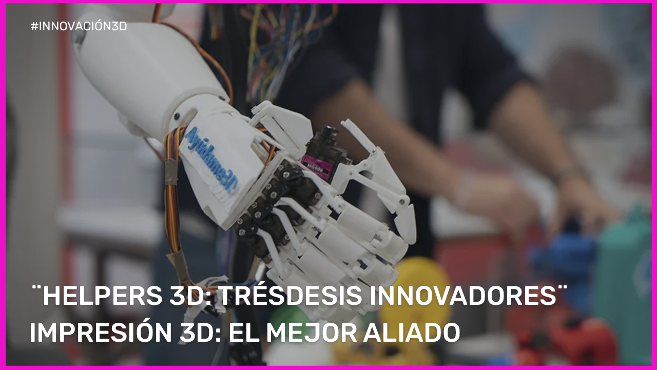 Innovación en biomedicina: Alba González crea ¨prótesis¨ 3D que previenen amputaciones