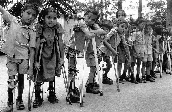 Children are particularly vunerable to Polio