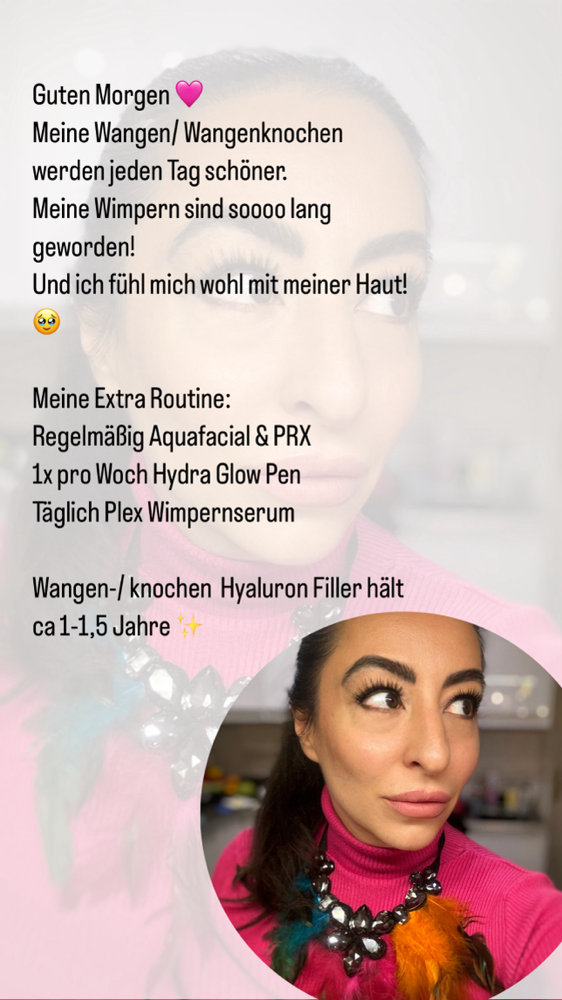 Serum 17€. Pen 149€. 