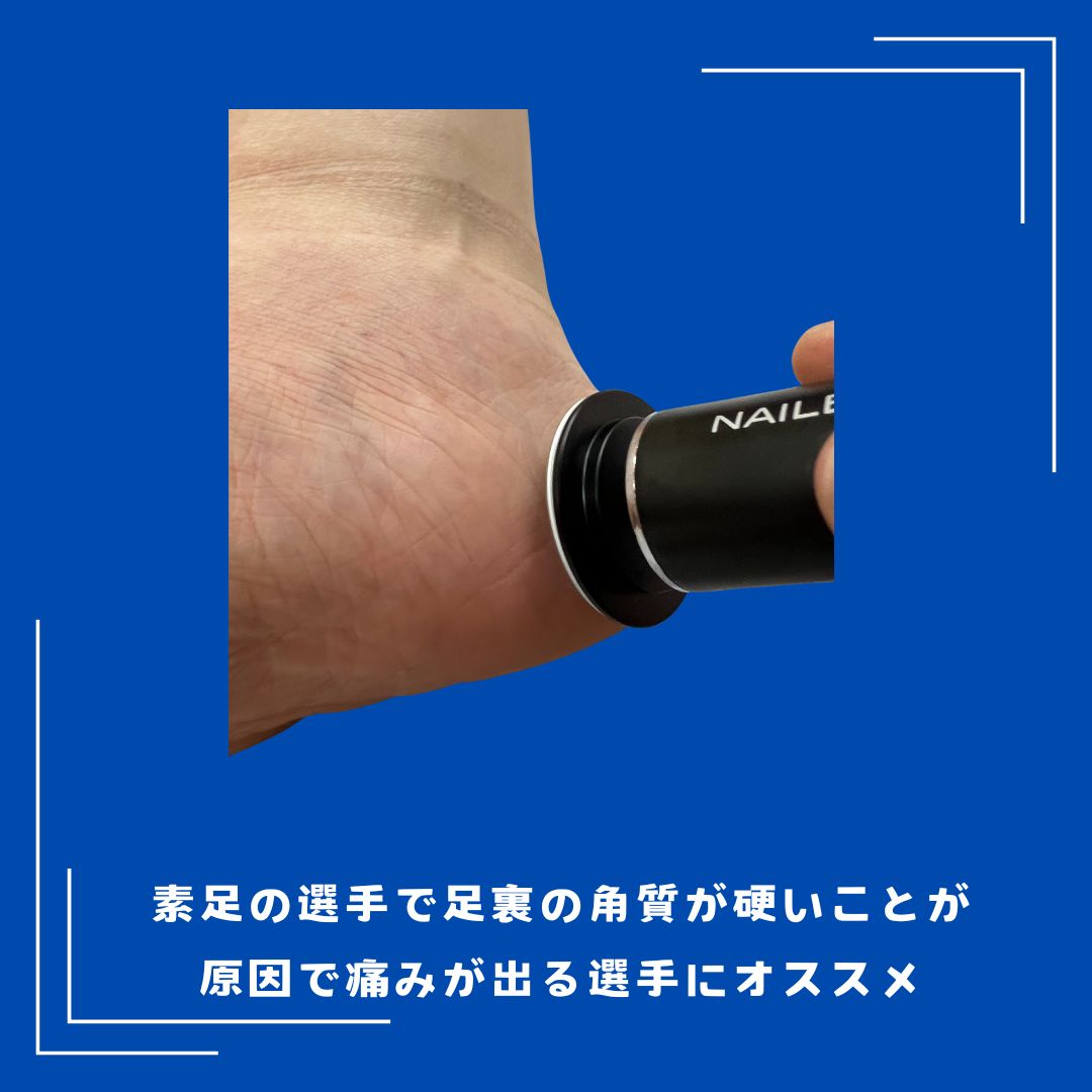 スポーツ選手にとって、足裏の角質ケアは非常に重要です