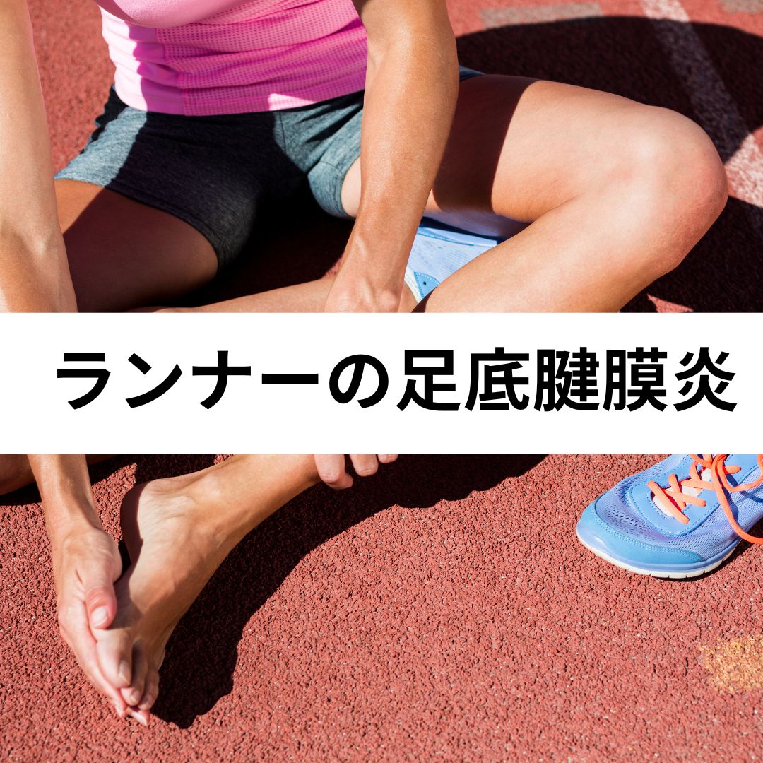 ランナーの足底腱膜炎