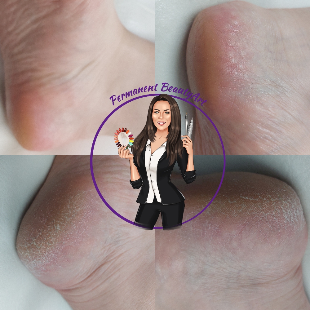 Kosmetische Fusspflege in Kriens bei Permanent BeautyArt 
