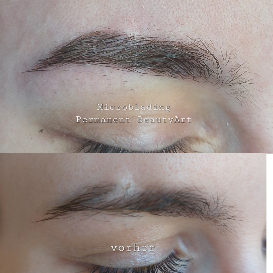 Microblading Härchenzeichnung über Narbe 