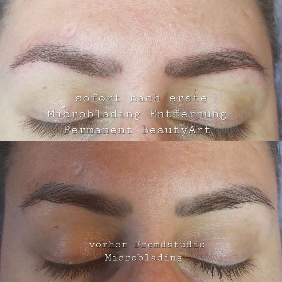 Microblading Entfernung ohne Laser in Kriens/Schweiz 