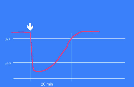 Die Absenkung des ph-Wertes unter der Plaque nach Zuckerzufuhr (Pfeil). Erst nach etwa 20 Minuten ist der neutrale Ausgangswert wieder erreicht.