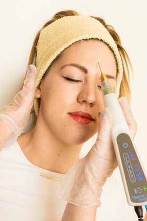 Faltenreduktion mit dem Plasma Lift