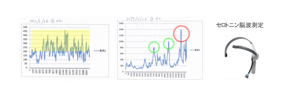 セロトニン脳波測定の結果（2019.2.26）